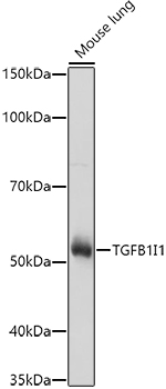 Anti-HIC5 Antibody