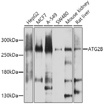 Anti-ATG2B Antibody