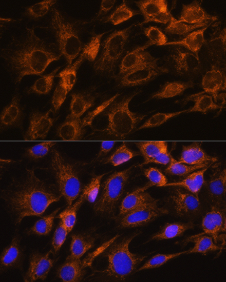 Anti-AQP8 Antibody Anti-AQP8 Antibody