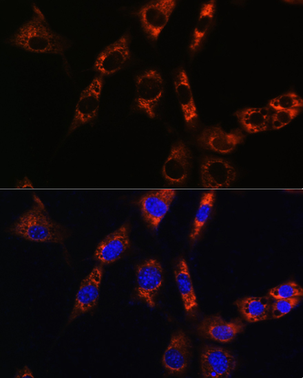 Anti-AQP8 Antibody Anti-AQP8 Antibody