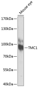 Anti-TMC1 Antibody