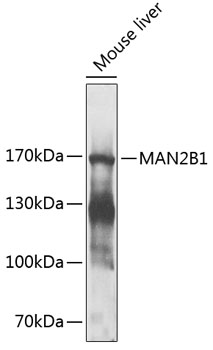 Anti-MAN2B1 Antibody