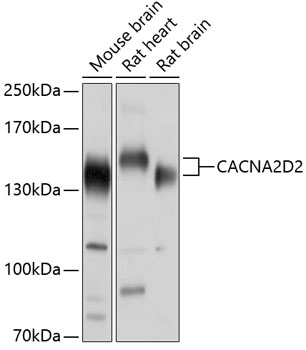 Anti-CACNA2D2 Antibody