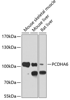 Anti-PCDHA6 Antibody