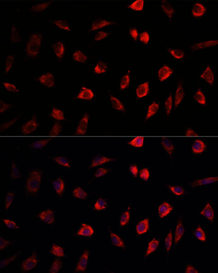 Anti-NEDD1 Antibody Anti-NEDD1 Antibody