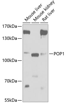 Anti-POP1 Antibody