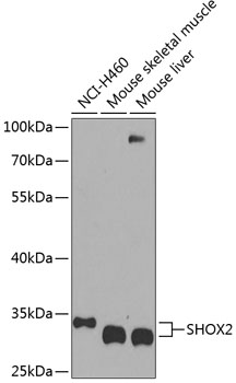 Anti-SHOX2 Antibody