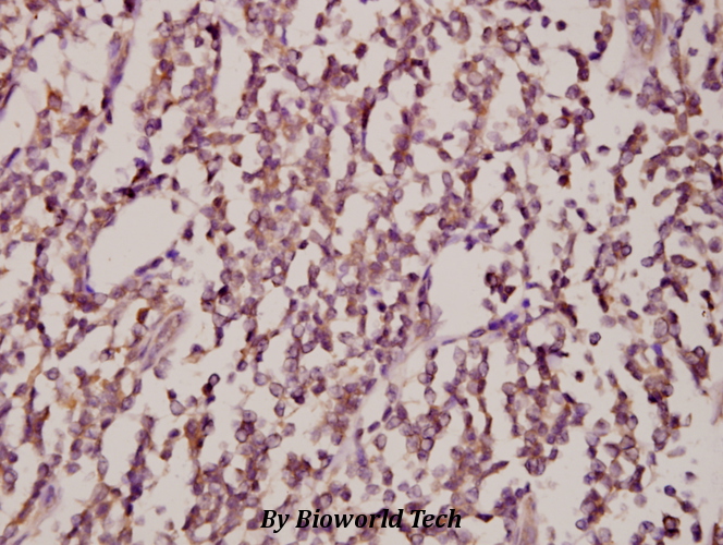 Anti-JNK1/2/3 (T183/Y185) Antibody Anti-JNK1/2/3 (T183/Y185) Antibody