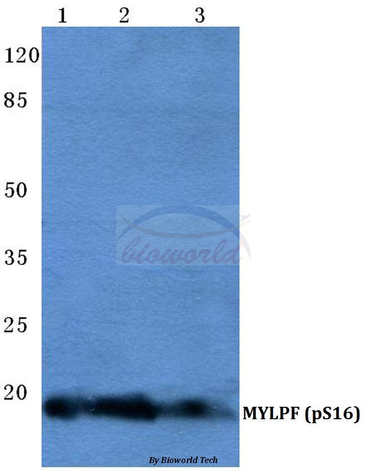 Anti-MYLPF (phospho-S16) Antibody