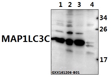 Anti-MAP1LC3C (P77) Antibody
