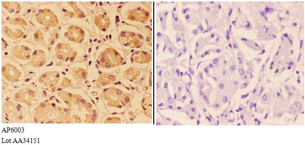 Anti-PTPRO Antibody Anti-PTPRO Antibody