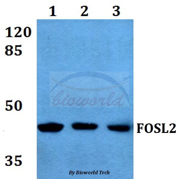 Anti-FOSL2 (S301) Antibody