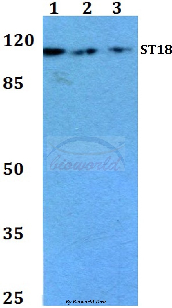 Anti-ST18 (E72) Antibody