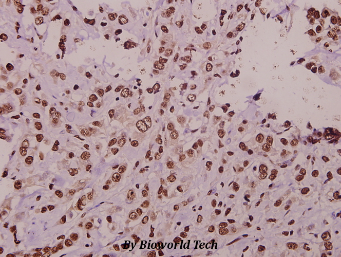 Anti-ST18 (E72) Antibody Anti-ST18 (E72) Antibody