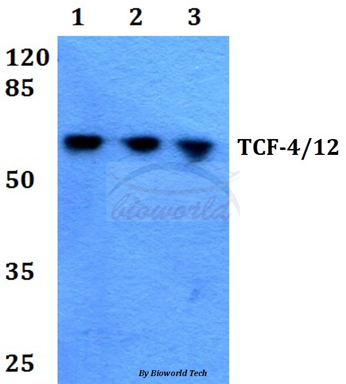 Anti-TCF-4/12 (S616) Antibody