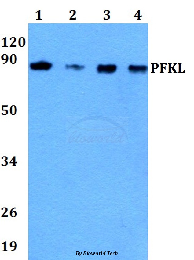 Anti-PFKL (E724) Antibody