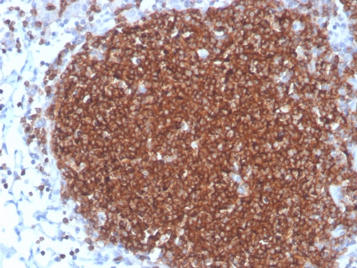 Anti-CD19 Antibody [rCD19/4591]