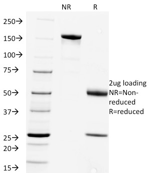 Anti-Rabies Virus Antibody [Rab-50]