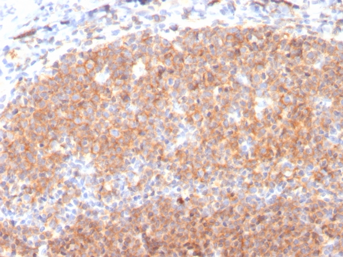 Anti-CD19 Antibody [CD19/3117] - BSA and Azide free