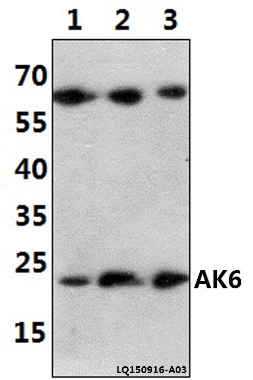 Anti-AK6 (G35) Antibody