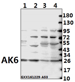 Anti-AK6 (G35) Antibody Anti-AK6 (G35) Antibody