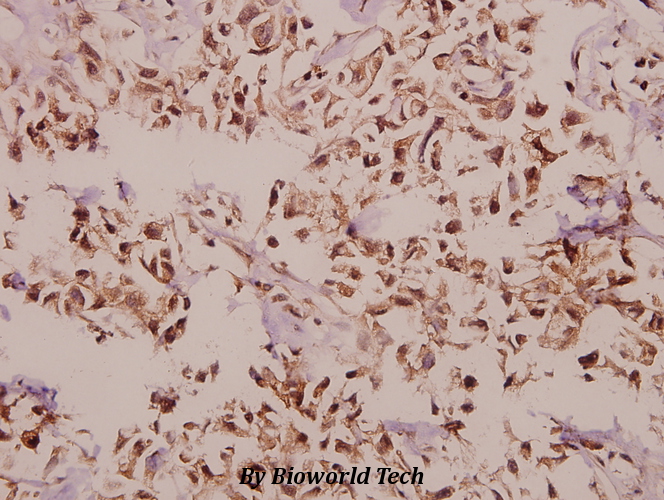 Anti-PEBP2beta (R33) Antibody Anti-PEBP2beta (R33) Antibody