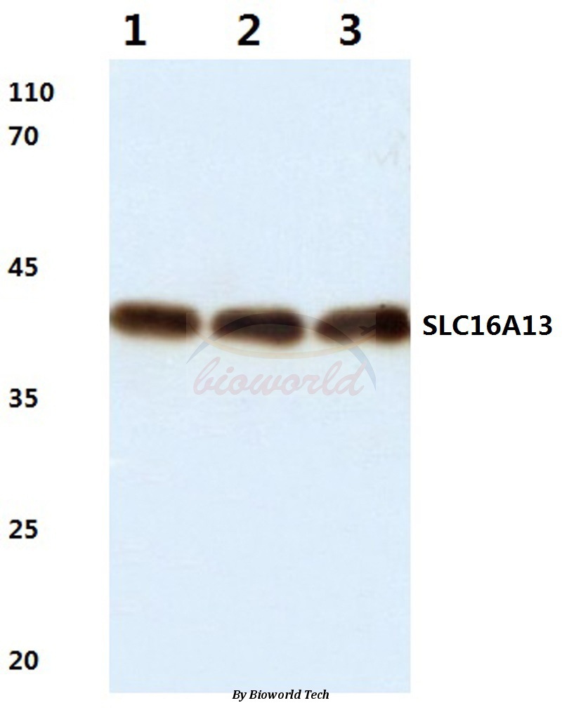 Anti-SLC16A13 (L423) Antibody