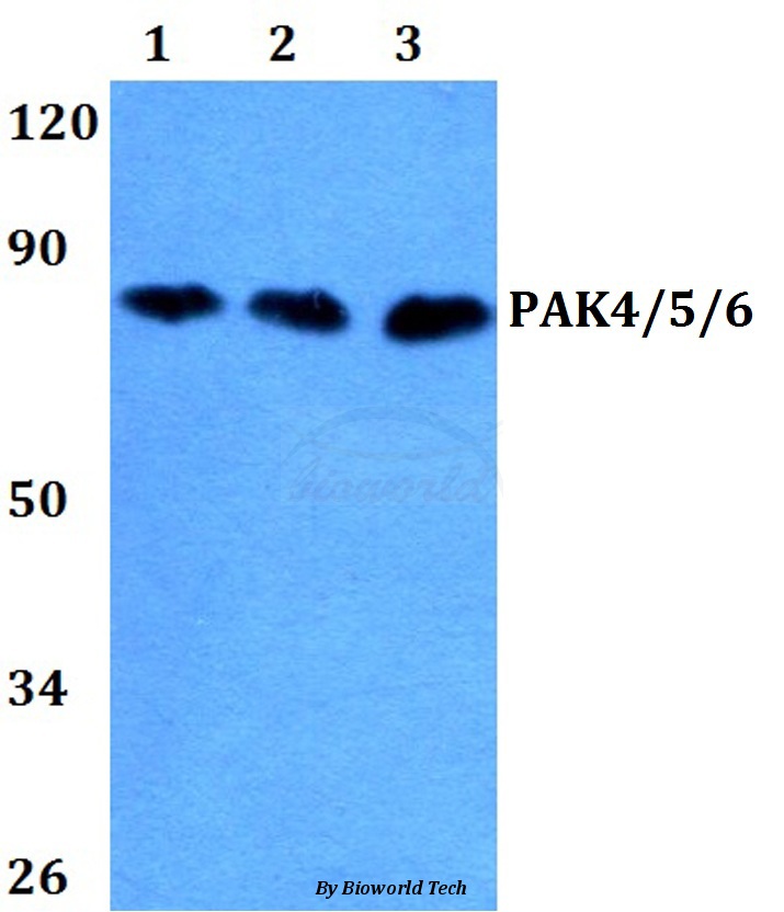 Anti-PAK4/5/6 (V469) Antibody