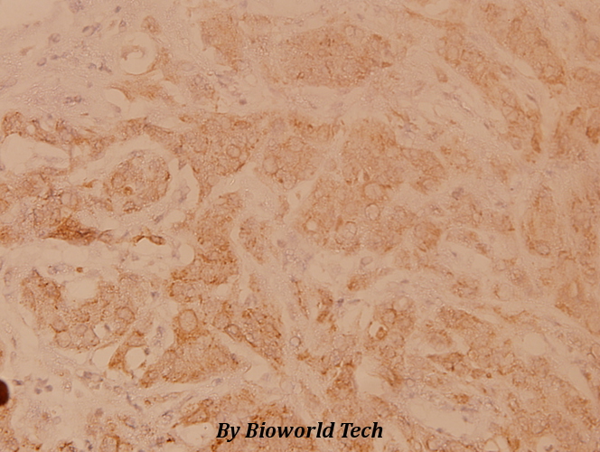 Anti-POLR3A (P68) Antibody