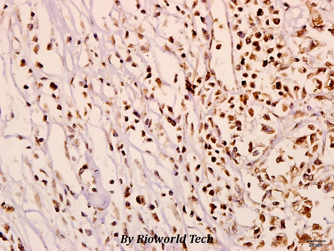 Anti-N4BP1 (Y415) Antibody Anti-N4BP1 (Y415) Antibody