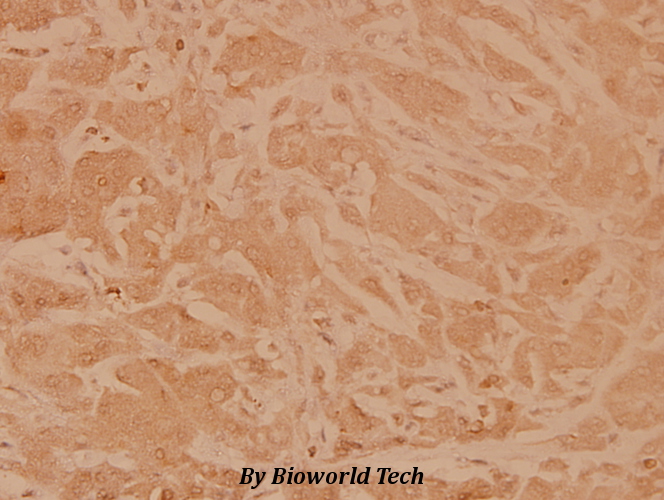 Anti-MEK1 (T286) Antibody Anti-MEK1 (T286) Antibody