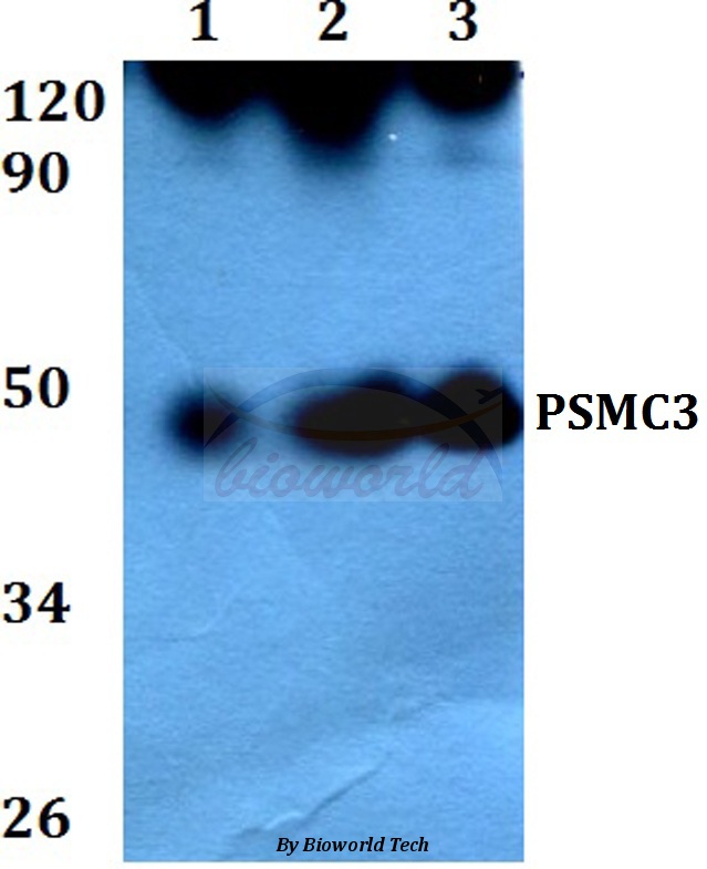 Anti-PSMC3 (V306) Antibody