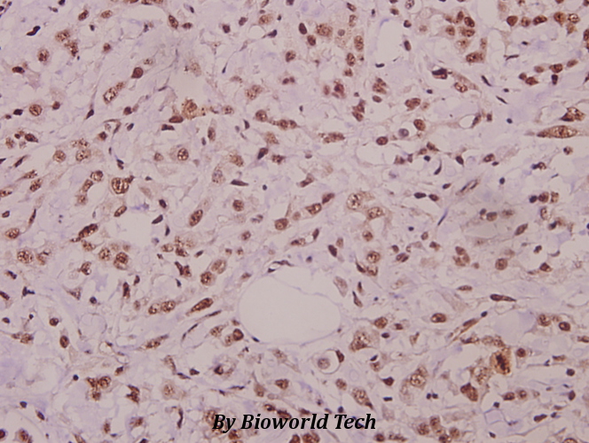Anti-JNK1/2/3 (phospho-T183) Antibody Anti-JNK1/2/3 (phospho-T183) Antibody