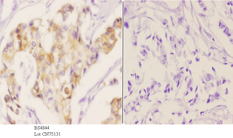 Anti-MEK1 (phospho-T286) Antibody Anti-MEK1 (phospho-T286) Antibody