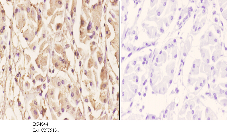 Anti-MEK1 (phospho-T286) Antibody Anti-MEK1 (phospho-T286) Antibody