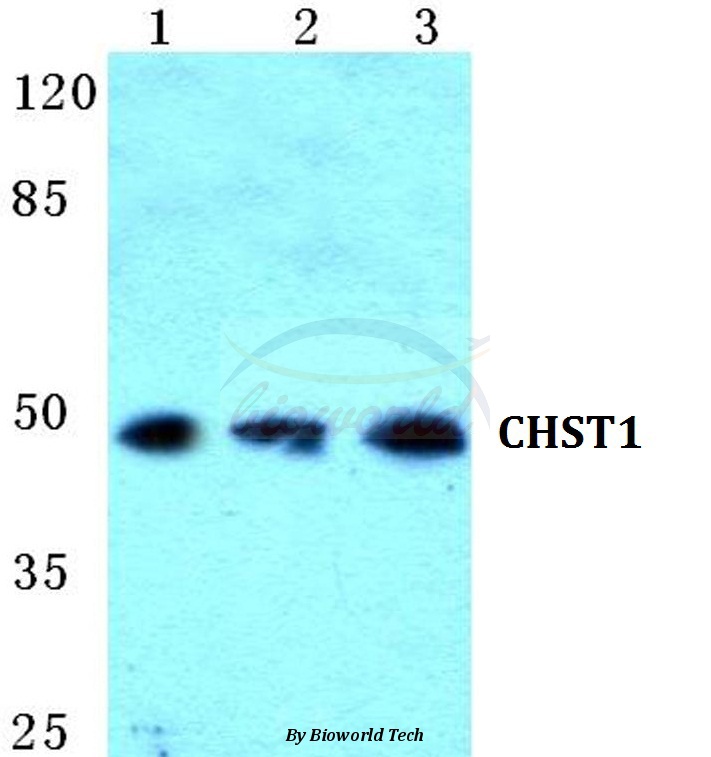 Anti-CHST1 Antibody