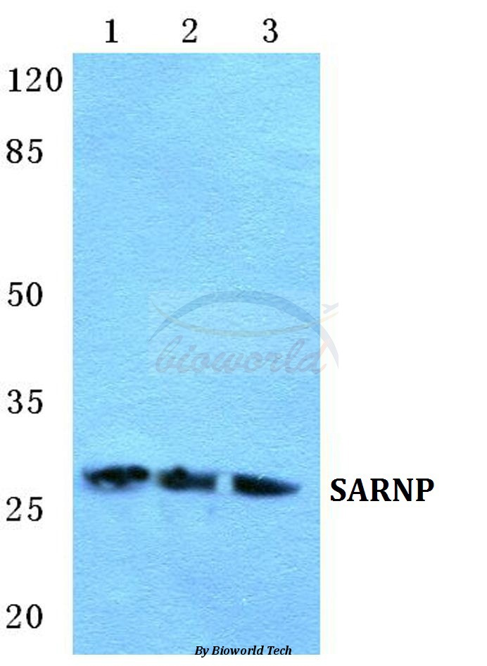 Anti-SARNP Antibody