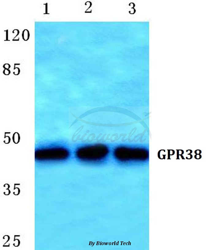 Anti-GPR38 Antibody
