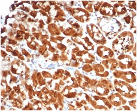 Anti-IL-2 Antibody [IL2/7051R]