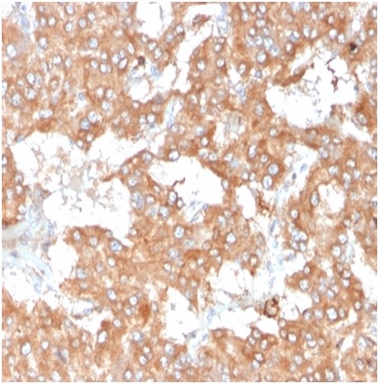 Anti-IL-2 Antibody [IL2/3950] - BSA and Azide free