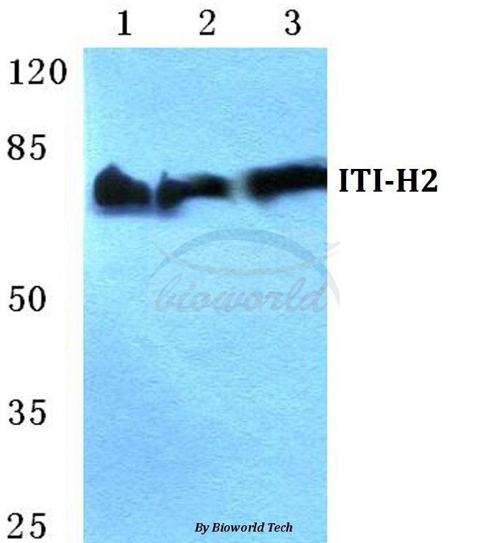Anti-ITI-H2 Antibody