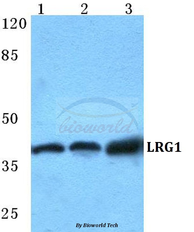 Anti-LRG1 Antibody