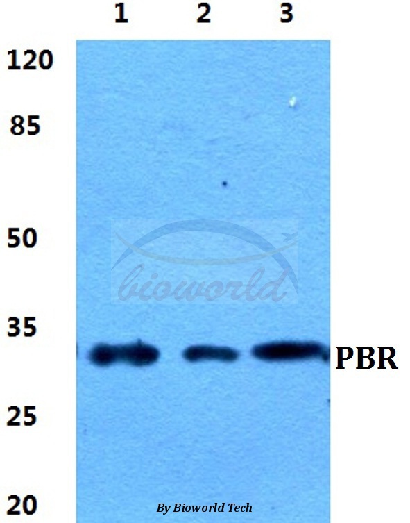 Anti-PBR Antibody