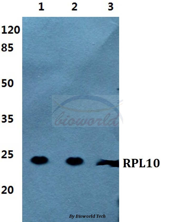 Anti-RPL10 Antibody