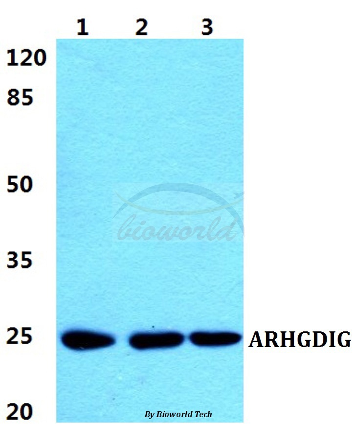 Anti-ARHGDIG Antibody