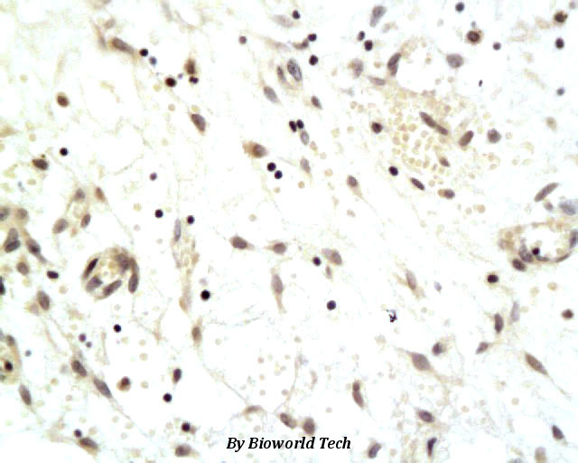 Anti-CDCA8 Antibody Anti-CDCA8 Antibody