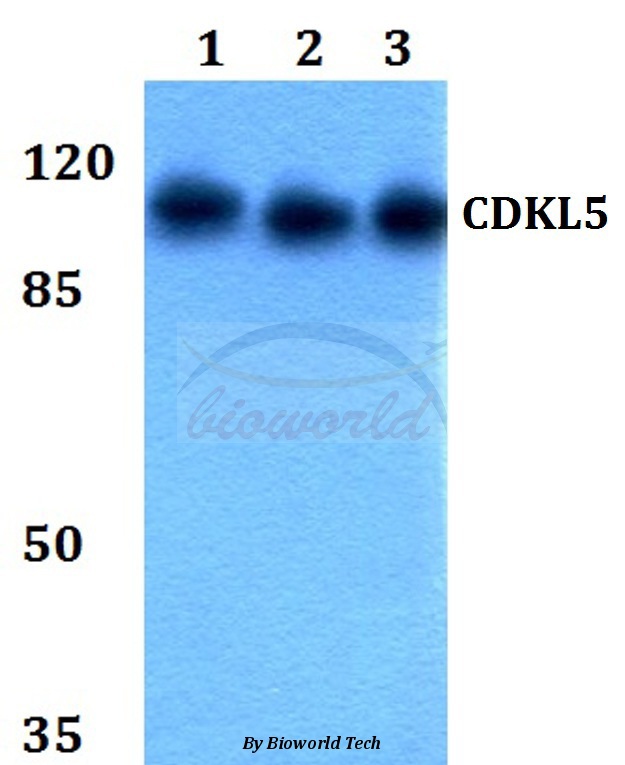 Anti-CDKL5 Antibody