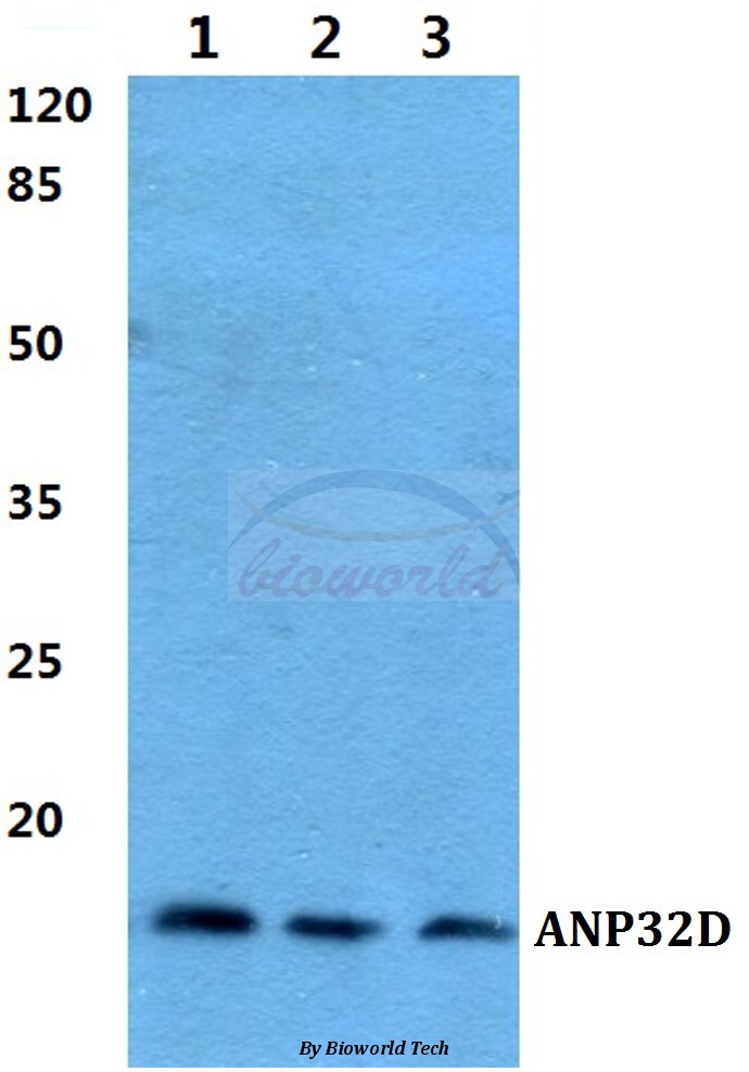 Anti-ANP32D Antibody