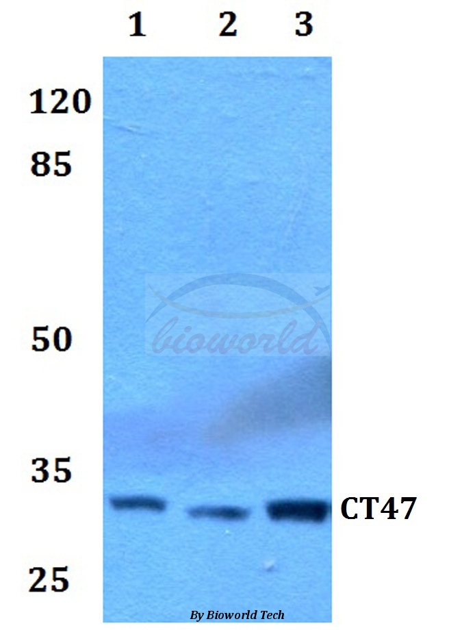 Anti-CT47 Antibody