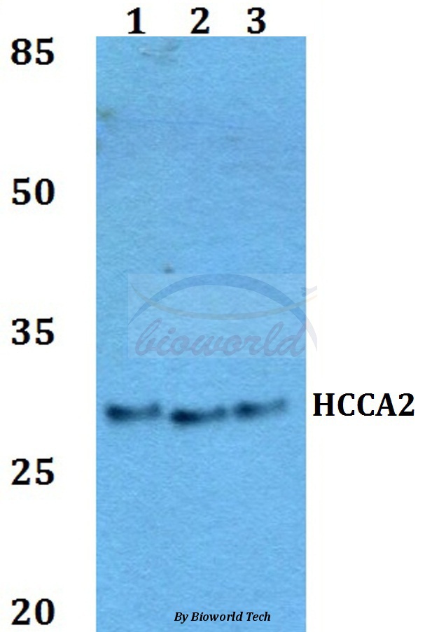Anti-HCCA2 Antibody